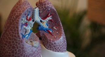 Donated Organs Cause Legionnaires’ Disease?