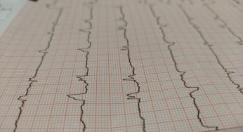 Heart Attack in a Can? Energy Drinks Linked to Cardiac Arrest!