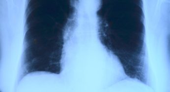 Legionnaires’ Disease in Lincoln Sickens Five People Near RiverWalk Resort
