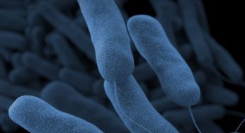 The Web’s Most Searched Questions About Legionnaires’ Disease