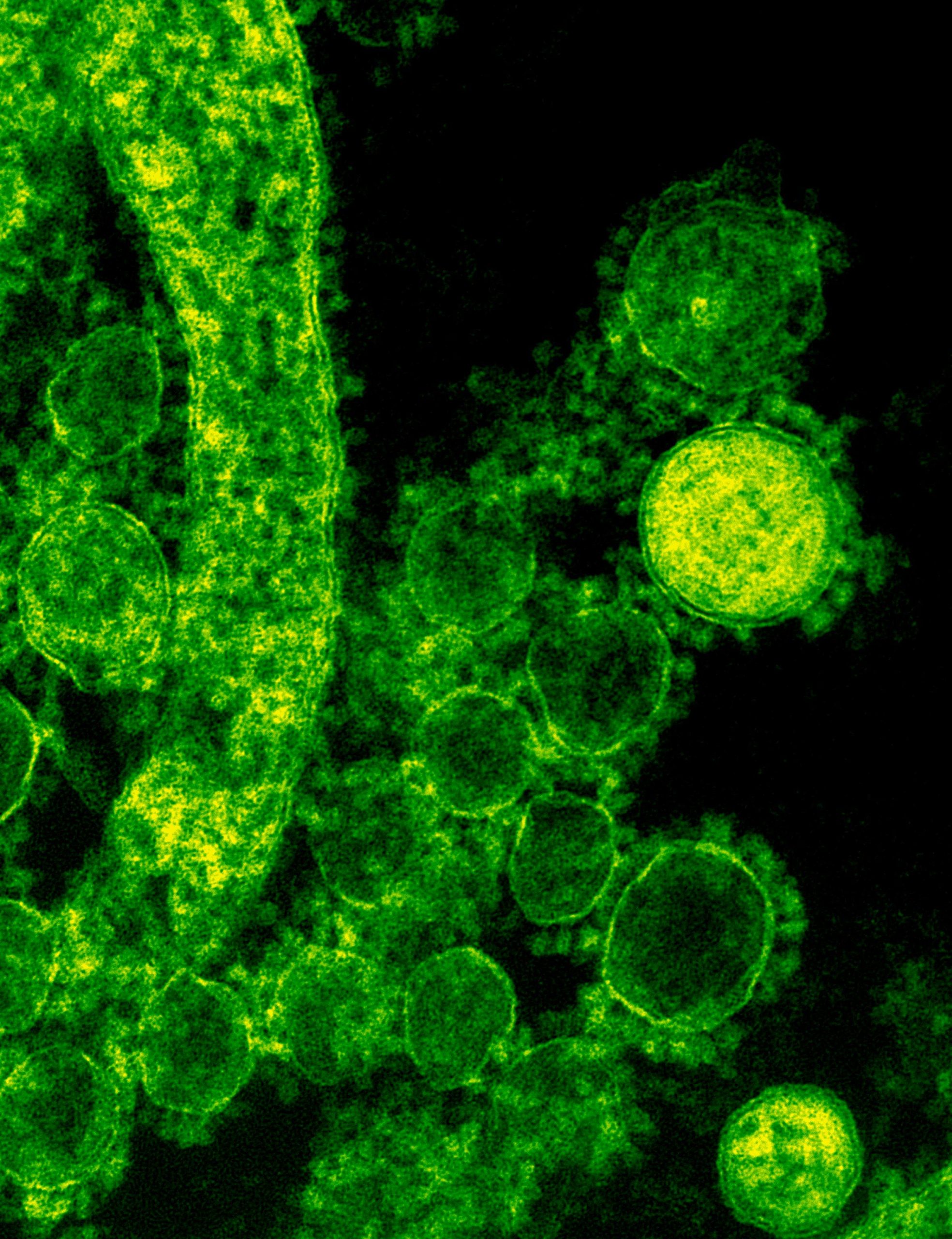 8 Most Antibiotic Resistant Bacteria in the World