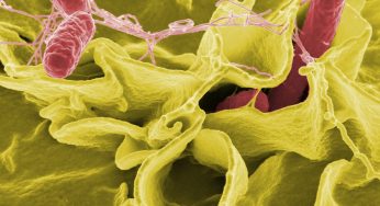How Salmonella Bacteria Outsmarts the Human Immune System