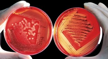 Researchers Discover New Method for Decontaminating Legionella Bacteria and Similar Hardy Environmental Pathogens